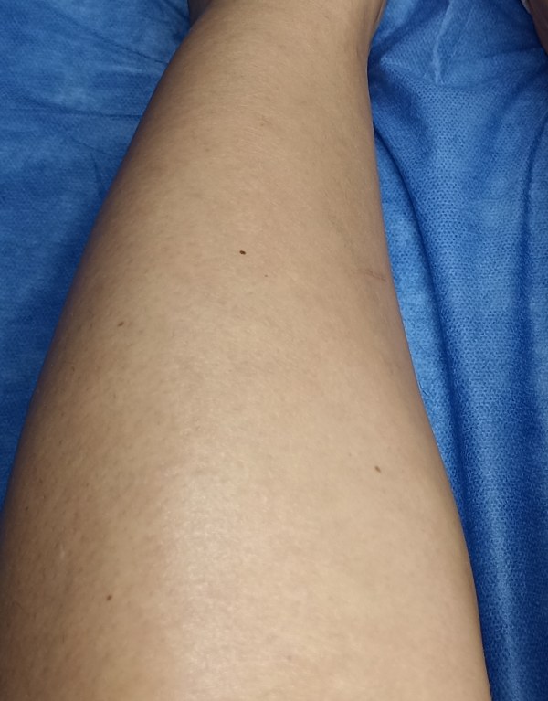 Depilación de piernas con cera